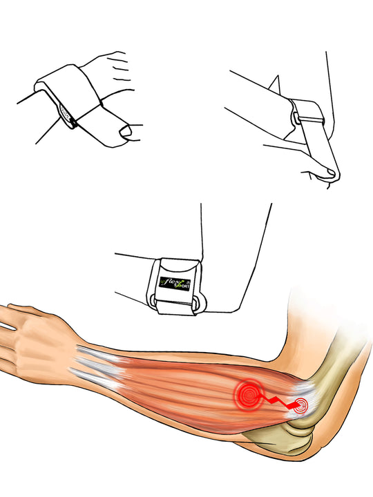 4DflexiSPORT Padel, Golf, Tennis Elbow Epicondylitis Strap
